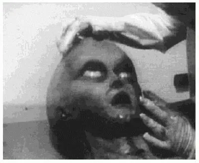 normal_AUTOPSY1.webp