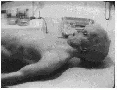 normal_AUTOPSY2.webp